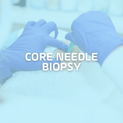 Core Needle Biopsy